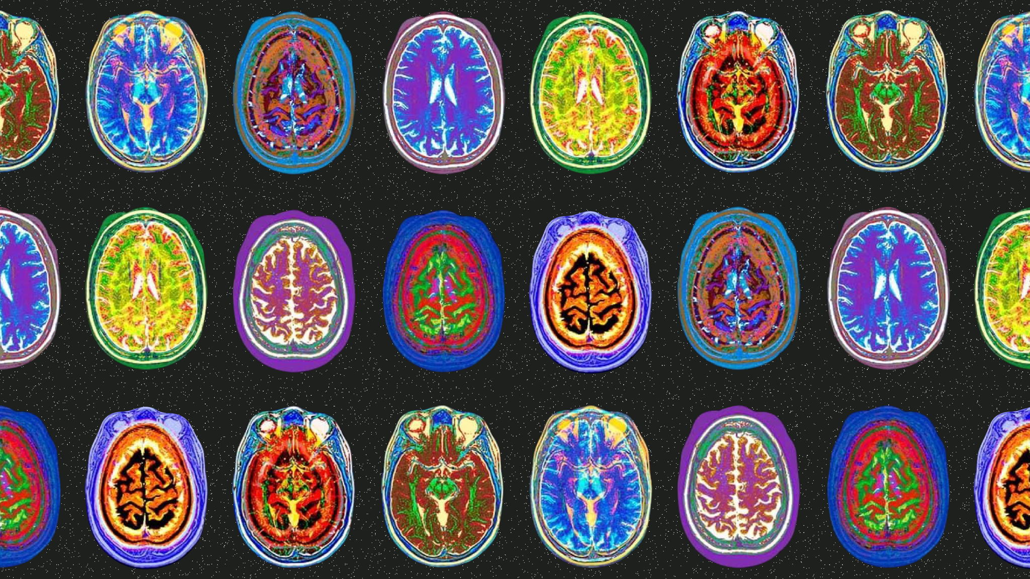 МОЗГОКАЧАЛКА