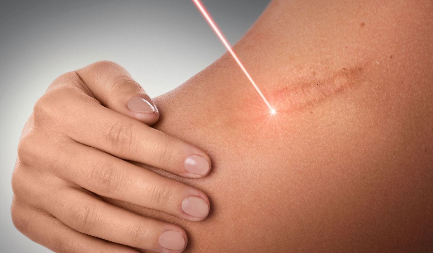 Вызовы и будущее коррекции дефектов кожи