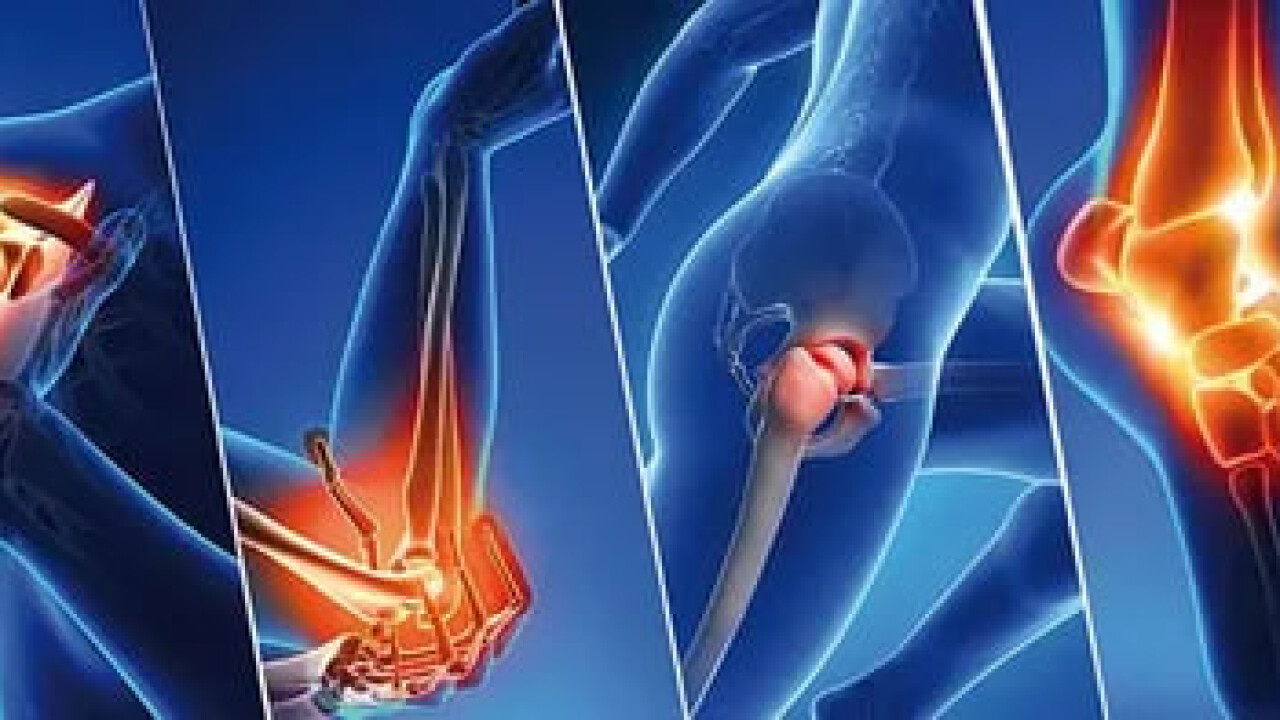 Вебинар: «Почему болят суставы и как вернуть лёгкость в теле»