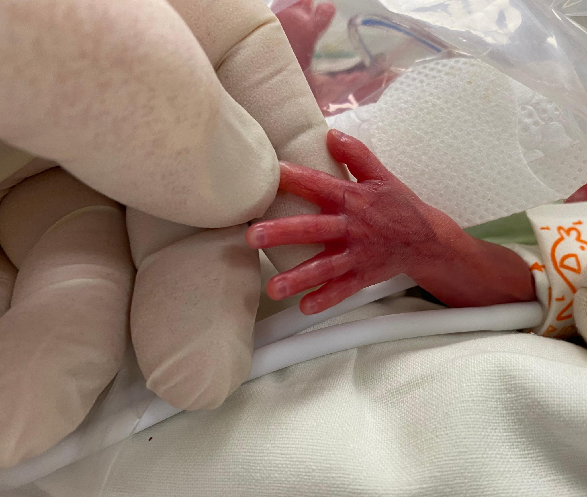 Презентация книги "The Birth of the Patient: Multiple Entities of Newborns in Russian Neonatal Care"