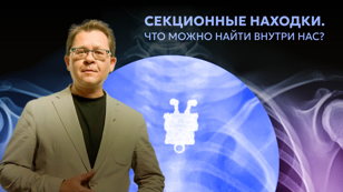 Лекция Алексея Решетуна “Секционные находки. Что можно найти внутри нас?”