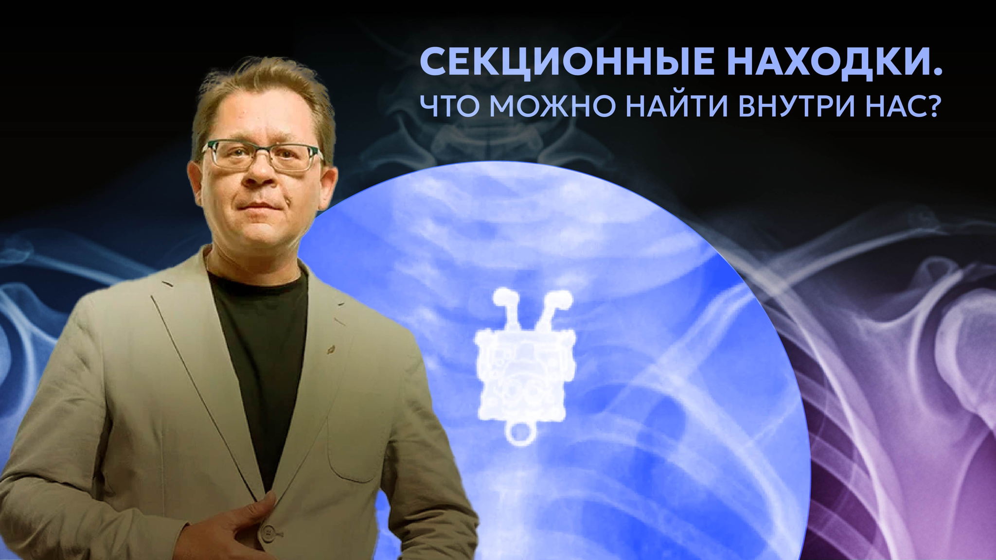 Лекция Алексея Решетуна "Секционные находки. Что можно найти внутри нас?”