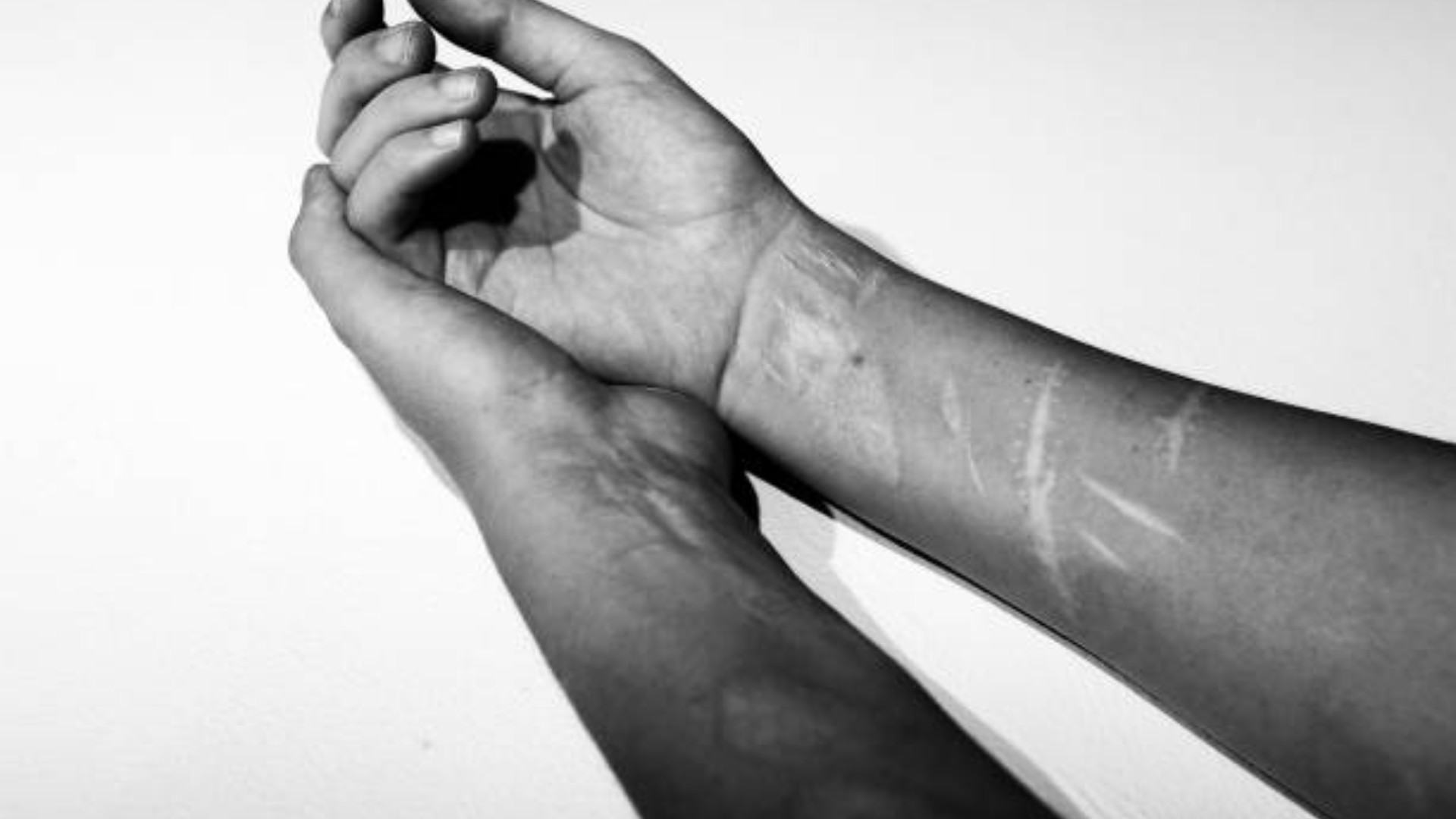 Работа с самоповреждениями