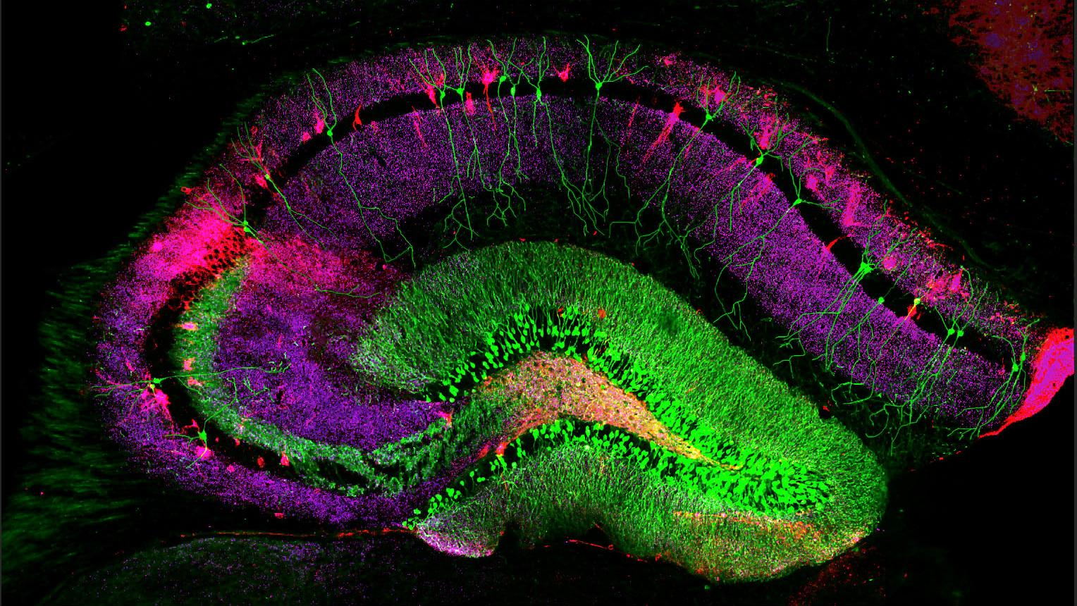 Онлайн-лекция Сергея Лопатина «Окна памяти: нейробиология воспоминаний»