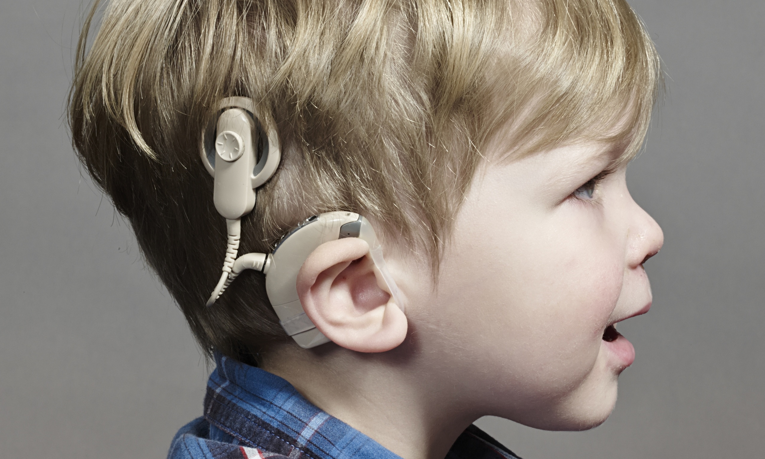 Слуховой аппарат для слабослышащих. Кохлеарная имплантация Cochlear. Кохлеарный имплант аппарат. Кохлеарный имплант Кохлер. Слуховой аппарат кохлеарный имплант.